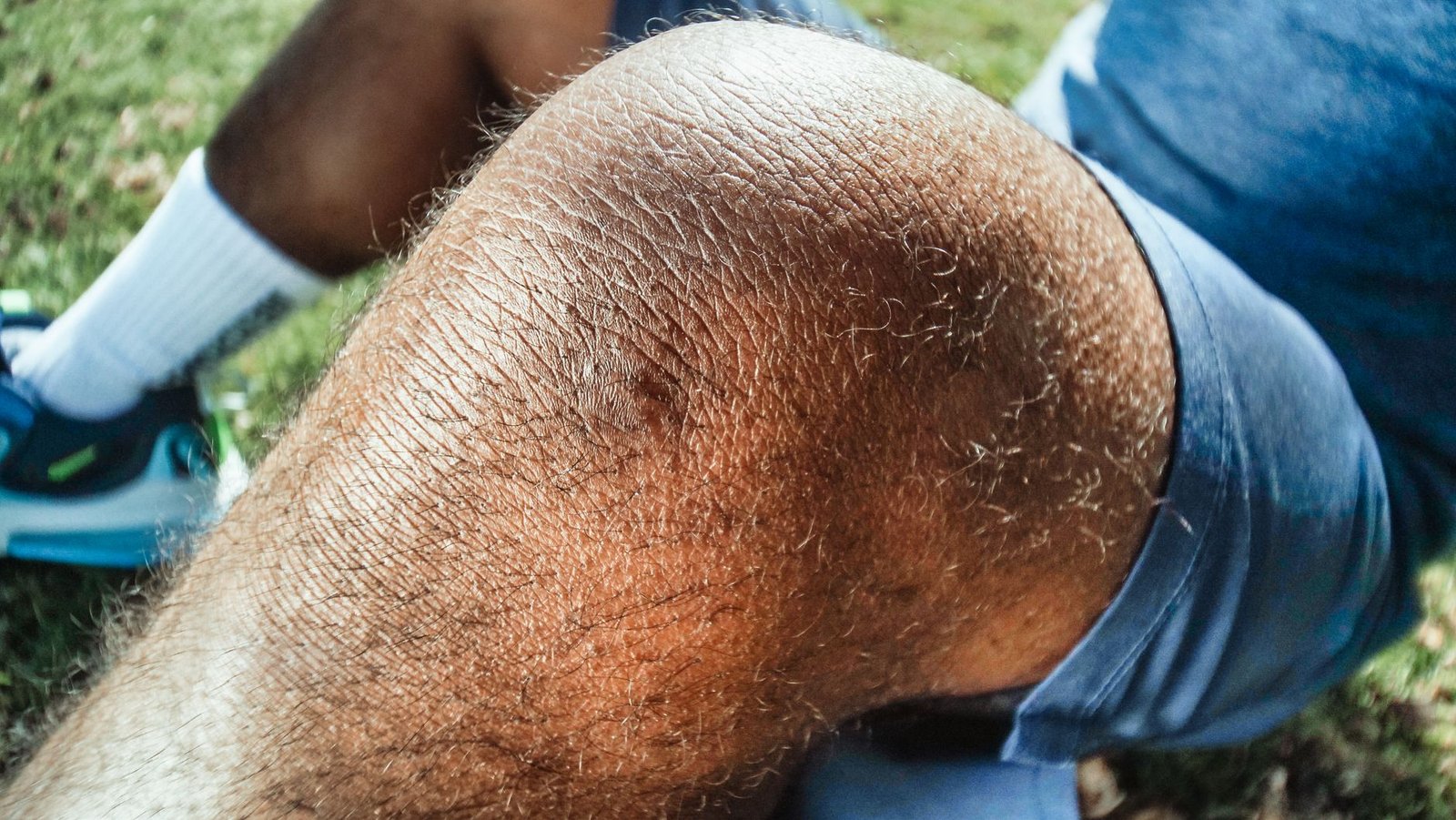 Athlete recovering from knee surgery, illustrating the rehabilitation process after a sports injury